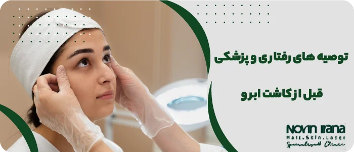 اقدامات قبل از کاشت ابرو